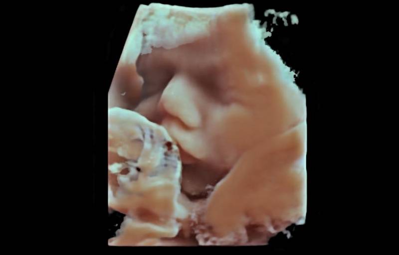 échographie obstétricale  de grossesse du troisième trimestre chez la femme enceinte a Roubaix